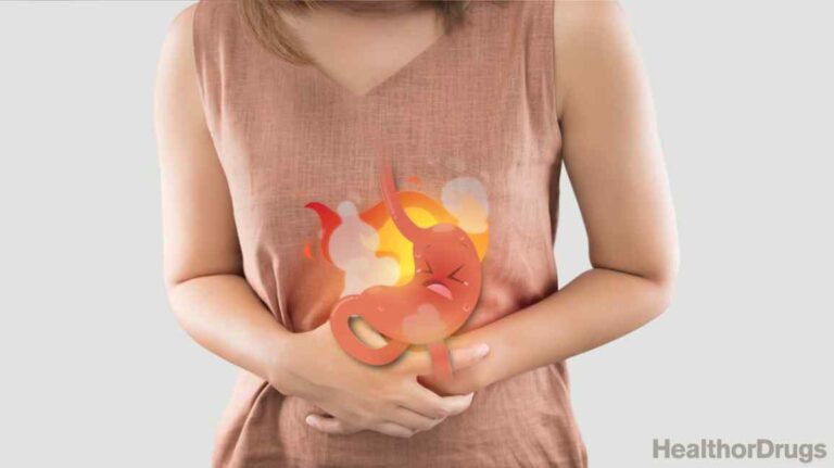 Does Omeprazole Help with Acid Reflux?
